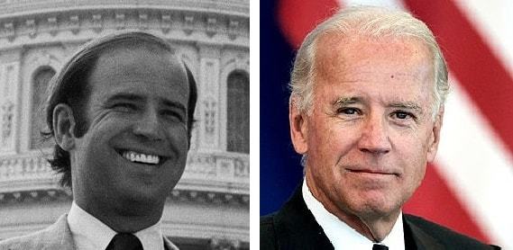 Mr. Joe Biden before and after hair transplant - Left: young Joe Biden with early male patterned baldness, Right: after hair transplant
