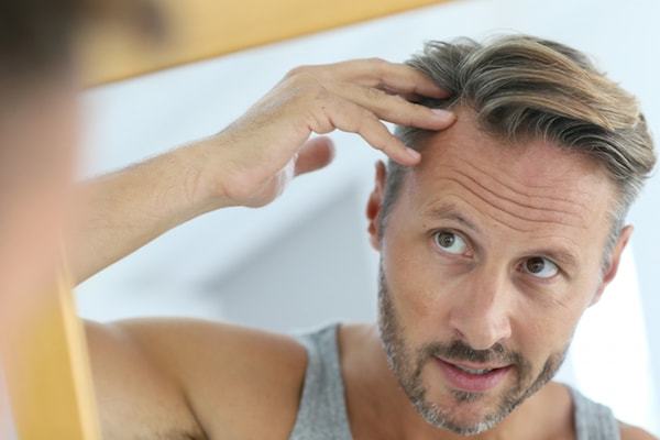 Male Psyche and Facial Hair Loss