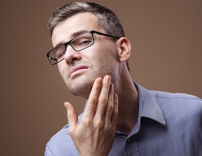 After Beard to Scalp Hair Transplant