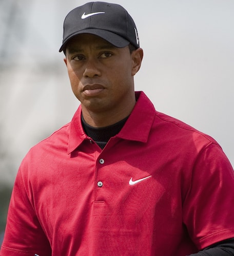 Tiger Woods and Hair Loss