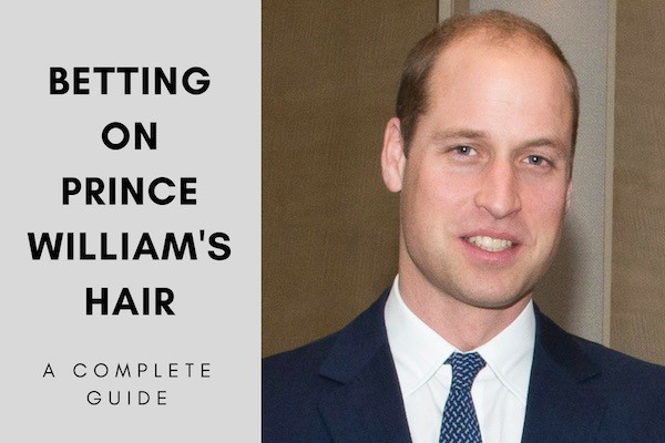 Hair transplant for Prince William