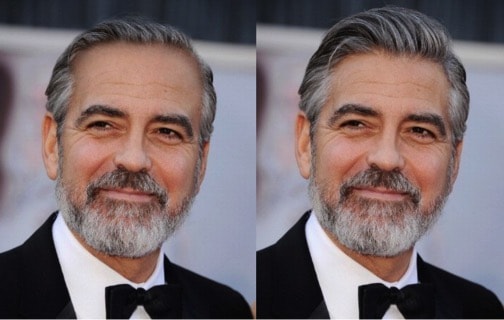 George Clooney Hair Transplants Los Angeles And San Francisco Parsa Mohebi Hair Restoration Hair Transplants Los Angeles And San Francisco Parsa Mohebi Hair Restoration