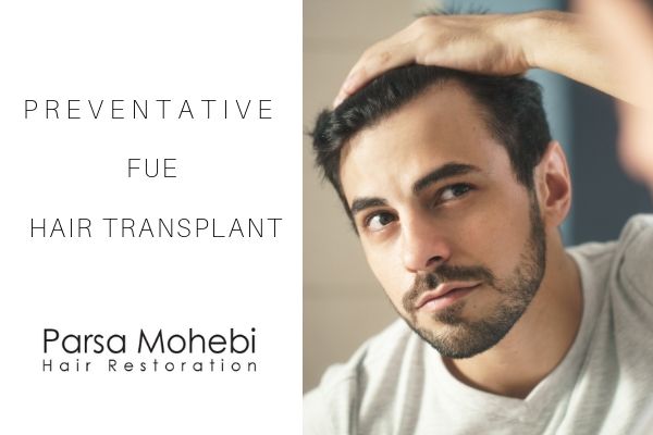 Preventative FUE Hair Transplant