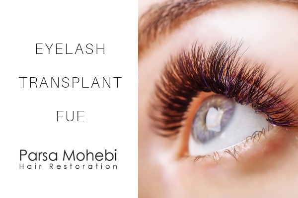Eyelash Hair Transplant - Case Study - Parsa Mohebi Hair Restoration
