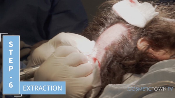 fue extraction