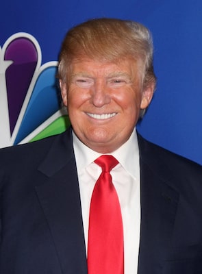 Did Donald Trump have a hair transplant