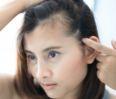 Female Hair Loss Medical Treatment