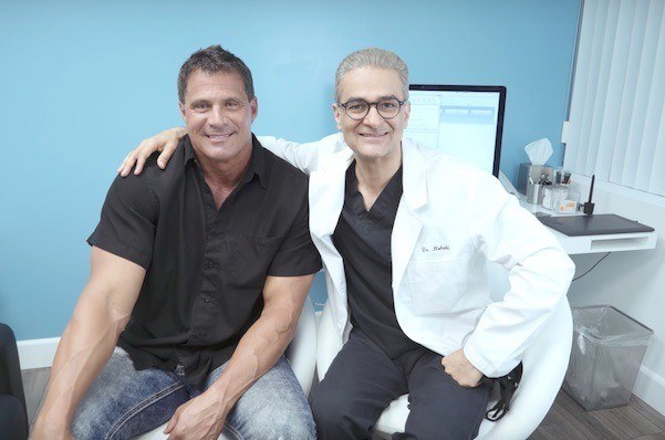 this is an image of hair transplant patient in Van Nuys