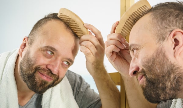 Connection between hair loss and diabetes