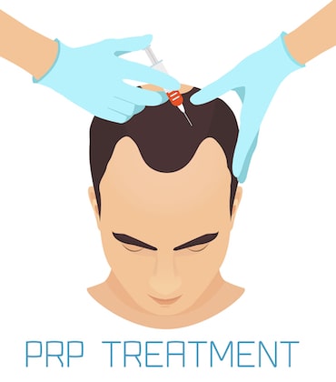 Is PRP helpful for hair loss
