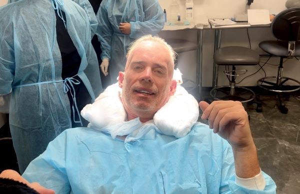 Inside Story of Joe Buck and His Latest Hair Transplant - Parsa Mohebi Hair  Restoration