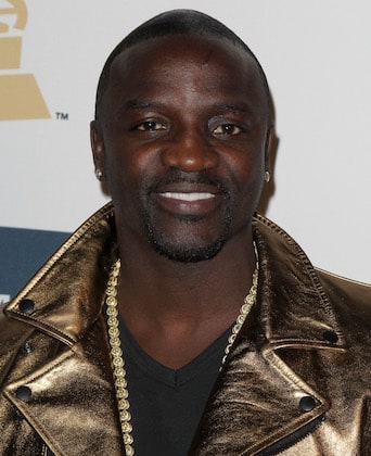 Akon talks about his hair transplant