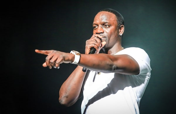Singer Akon had a hair transplant