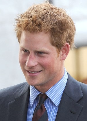 Hair transplant speculation for Prince Harry