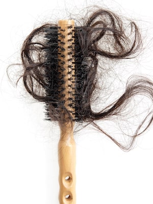 Female Hair Loss for those with Dark Skin