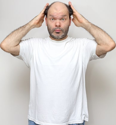 Learn how poor diet can cause hair loss