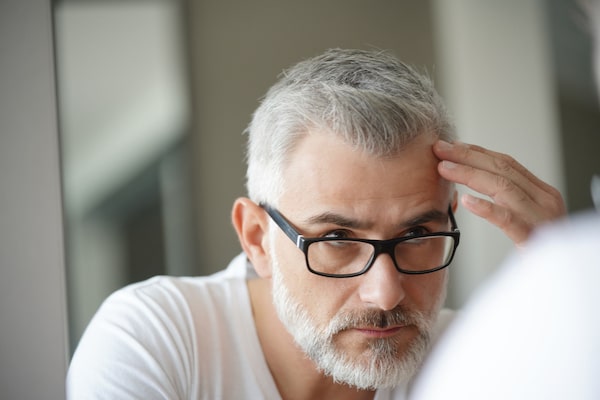 Can I lose my transplanted hair after having a hair transplant